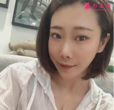 韓緣聚美做水氧活膚怎么樣呢？案例30天術(shù)后效果真的好極了