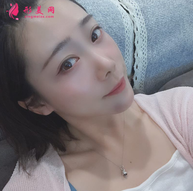 韓緣聚美做水氧活膚怎么樣呢？案例30天術后效果真的好極了
