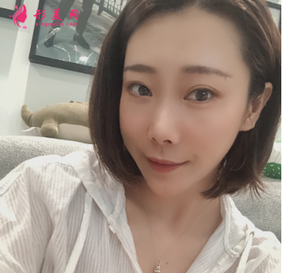 韓緣聚美做水氧活膚怎么樣呢？案例30天術后效果真的好極了