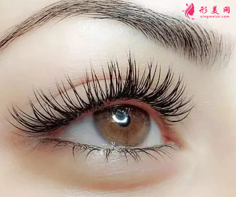 什么情況適合做開眼角