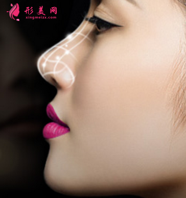 假體隆鼻多久可以恢復自然