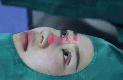 上海九院整形科怎么樣？附雙眼皮30天恢復(fù)真實(shí)記錄