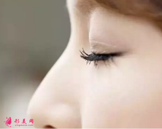 雙眼皮手術(shù)后睜眼無(wú)力怎么回事