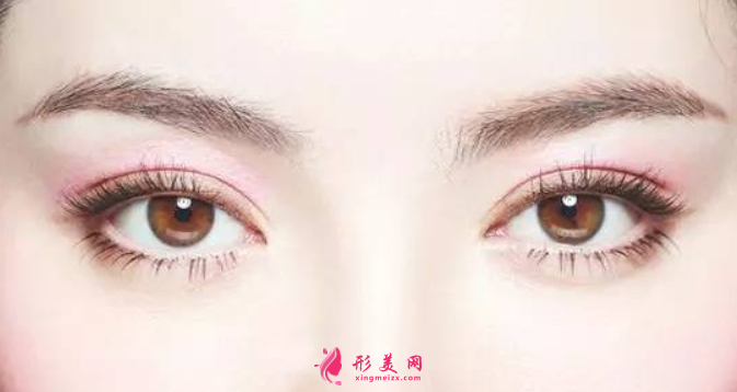 雙眼皮手術(shù)后睜眼無(wú)力怎么回事