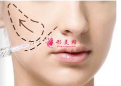 玻尿酸填充的效果可以保持多長時間？