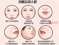 臉部做埋線提升會(huì)表情僵硬嗎？