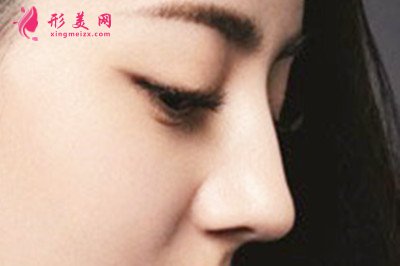 硅膠隆鼻會(huì)出現(xiàn)包膜攣縮嗎