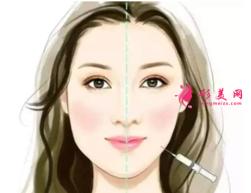 打瘦臉針注意事項是什么
