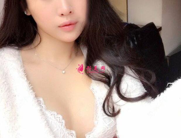 隆胸術(shù)后30天