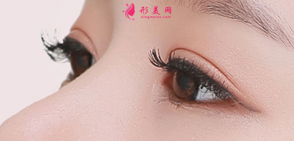 雙眼皮手術(shù)失敗修復(fù)難度大嗎