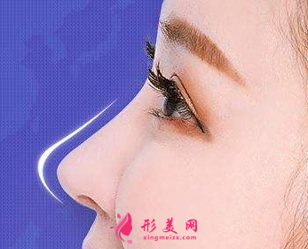 自體軟骨隆鼻的缺點(diǎn)是哪些