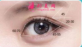 開眼角整形手術(shù)恢復(fù)時間