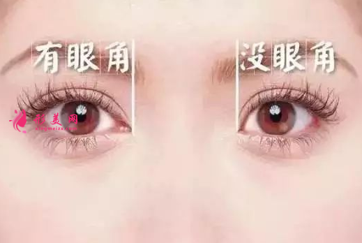 開眼角手術會不會很痛