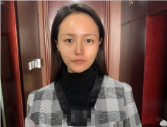 北京新星靚失敗案例有嗎？全新雙眼皮案例曝光~