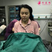 煙臺(tái)鵬愛整形面部線雕前后對(duì)比圖+醫(yī)院醫(yī)生介紹與推薦