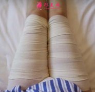 北京純脂大腿吸脂1-60天恢復(fù)經(jīng)驗(yàn)分享+醫(yī)院口碑介紹