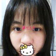上海華美整形醫(yī)院做假體隆鼻，讓我的鼻子更加精致好看
