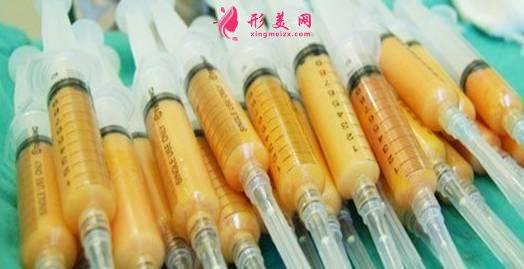 自體脂肪面部填充術(shù)前準備