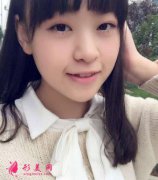 上海華美整形醫(yī)院隆鼻怎么樣？手術30天對比圖分享
