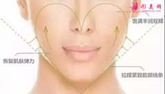 自體脂肪填充面部效果可以保持多久？