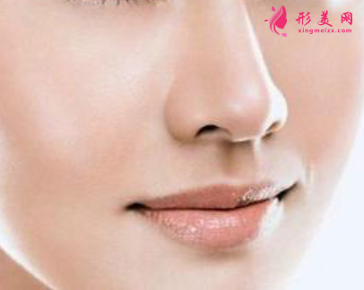 自體軟骨隆鼻術(shù)后效果好不好