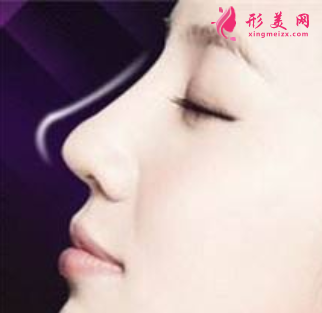 自體軟骨隆鼻的價(jià)格是多少