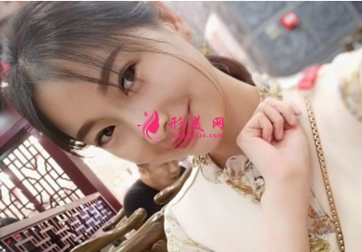瘦臉針效果好不好？看我的術(shù)后恢復(fù)吧~