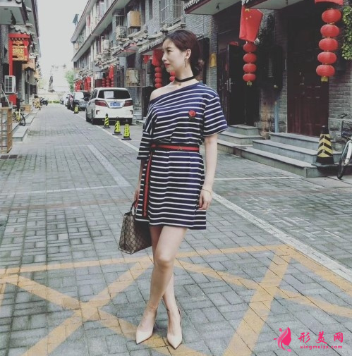 瘦臉針效果好不好？看我的術(shù)后恢復(fù)吧~