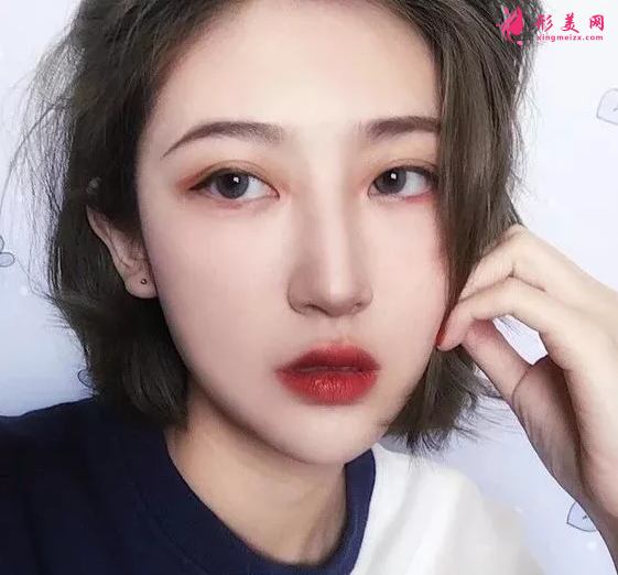 假體隆鼻哪種好？親身經(jīng)歷講述~