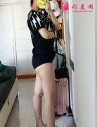 成都東籬醫(yī)院整形醫(yī)院大腿吸脂真人實拍案例，秒變小辣妹