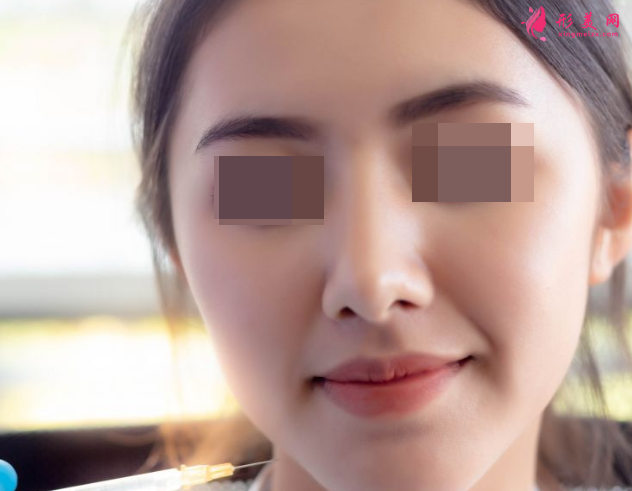 自體脂肪填充多久恢復(fù)自然