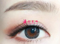 眼睛變大的手術方法？