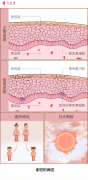 臉上的雀斑要怎么祛掉？