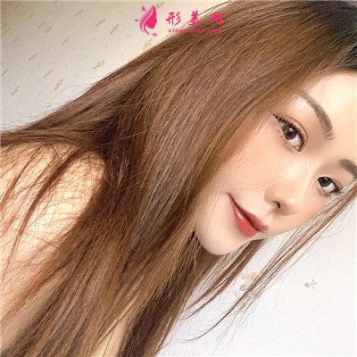 武漢耳軟骨隆鼻術后恢復情況分享