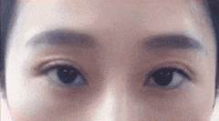 怎樣可以讓眼睛變成雙眼皮