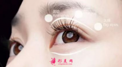 一般做雙眼皮要多少錢？