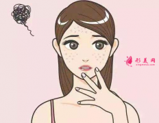 如何改善臉上的色斑？