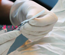 膨體隆鼻手術(shù)多少錢？