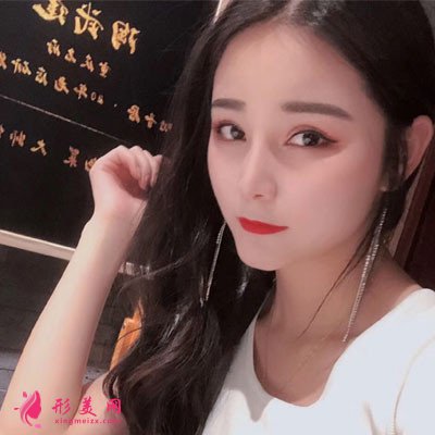 武漢眉毛種植手術(shù)術(shù)后恢復(fù)效果分享 術(shù)后 武漢眉毛種植手術(shù)術(shù)后恢復(fù)效果分享
