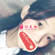 廣州軍美整形醫(yī)院假體隆鼻案例心得分享 比原生鼻還自然