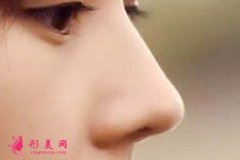 軟骨隆鼻的效果多久穩(wěn)定下來？