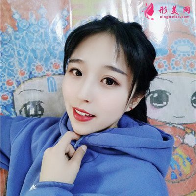 成都注射瘦臉針瘦臉術(shù)后效果對(duì)比