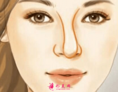 隆鼻歪了怎么修復(fù)