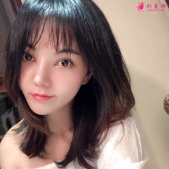 女人無需傾國傾城的整形術(shù)后圖片
