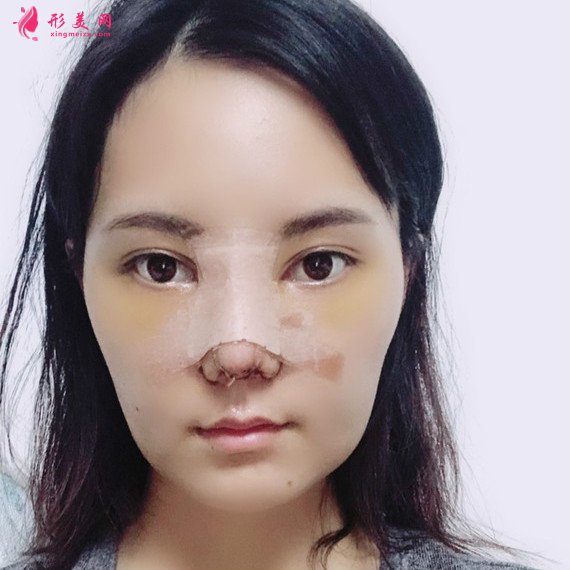 女人無需傾國傾城的整形術(shù)后圖片