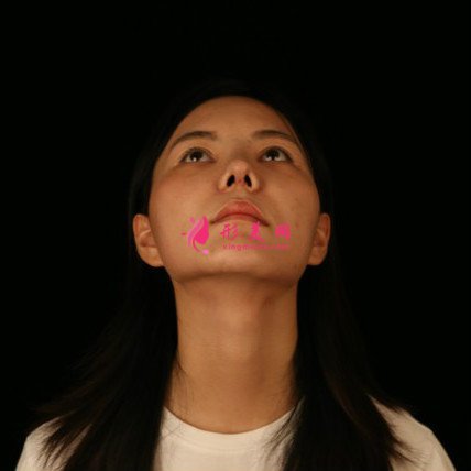 女人無需傾國傾城的整形術(shù)后圖片