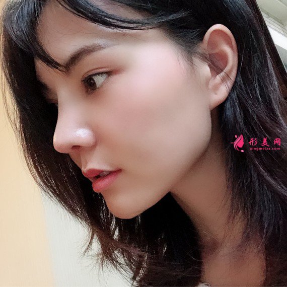 女人無需傾國傾城的整形術(shù)后圖片