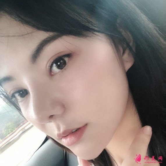 女人無需傾國傾城的整形術(shù)后圖片