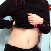 四川友誼醫(yī)院整形科腰腹吸脂案例、肚子很平坦，穿啥都好看