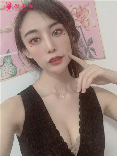 重慶小姐姐自體脂肪隆胸案例分享